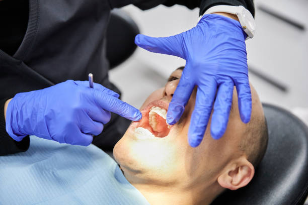 Best Cracked Tooth Emergency Dentist  in USA